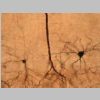 Neuronas Golgi 09.jpg